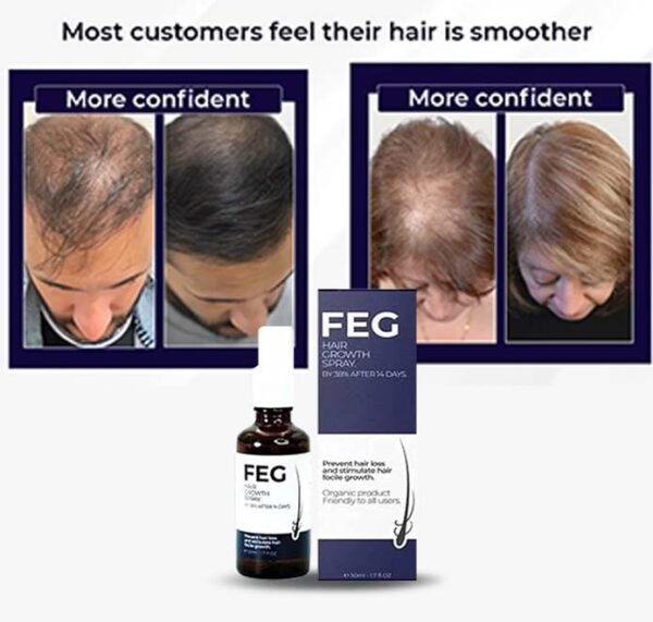 Hair Growth Spray